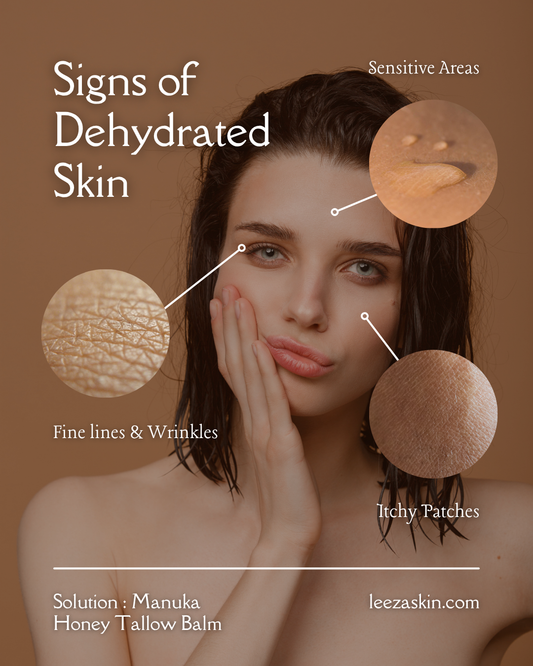 The Secret to Eliminating Dehydrated Skin: Why Manuka Honey Tallow Balm is Your New Holy Grail